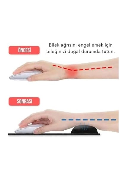 Bilek Destekli Jel Mouse Pad,ergonomik Kaymaz Taban,oyun ve Ofis Için Fare Altlığı,suya Dayanıklı (Siyah)