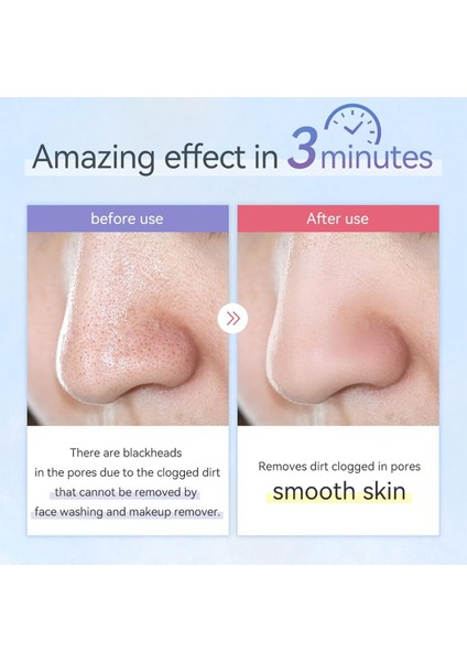 Ultrasonik Peeling Cilt Temizleyici, Siyah Nokta & Gözenek Temizleyici, Ipx5 Su Geçirmez modelleri