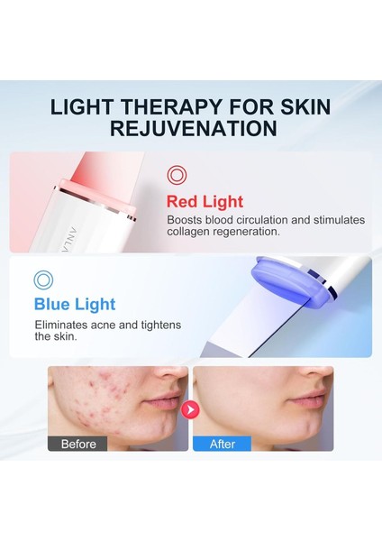 6’sı 1 Arada Ultrasonik Cilt Peeling Cihazı, Su Geçirmez, Ems, LED Işık Terapili Gözenek Temizleyici fırsatları