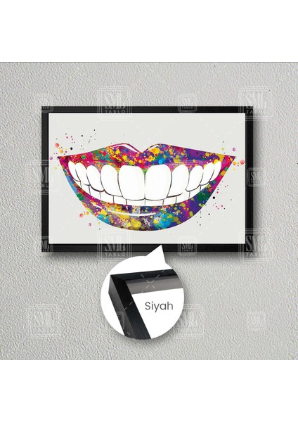 Renkli Gülücük Beyaz Dişler Diş Hekimi Poliklinik Çerçeveli Yatay Kanvas Tablo