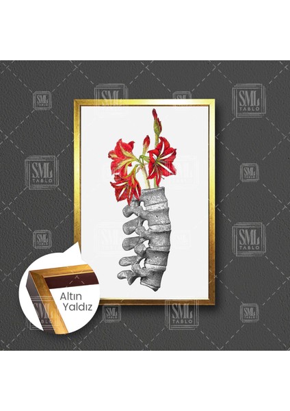 Omurga Sağlığı ve Kırmızı Çiçekler Fizyoterapi Beyin ve Sinir Cerrahisi Çerçeveli Dikey Kanvas Tablo