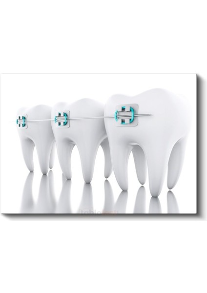 Ortodontist - Modern Ortodonti Teknikleri Kanvas Tablo fiyatları