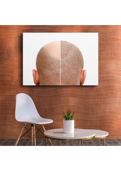 Saç Ekimi Uzmanı - Yeni Başlangıç Kanvas Tablo