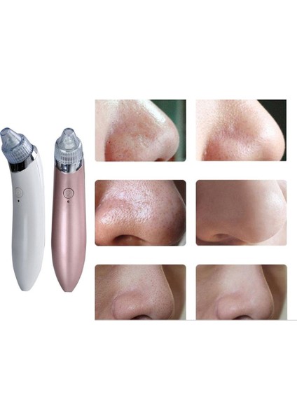 Ev Şarj Edilebilir Vakumlu Siyah Nokta Remover Yüz Vakum Gözenek Temizleyici Burun Akne Yüz Cilt Bakım Cihazı (Yurt Dışından) fiyatları