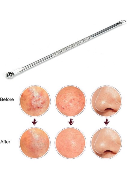 Paslanmaz Çelik Çıkarıcı Siyah Nokta Çıkarıcı Iğneler Nokta Temizleyici Akne Leke Çıkarıcı Iğneler Seti Siyah Nokta Gözenek Temizleyici (Yurt Dışından) fiyatları