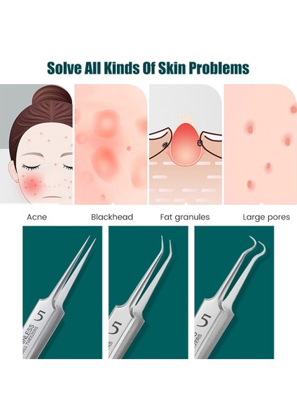 Çelik Hücre Klipsli Cımbız Ultra-Ince Akne Paslanmaz Siyah Noktaları Kaldırmak ve Akne Sıkmak Için Güzellik Salonları Için Akne Araçları (Yurt Dışından) modelleri