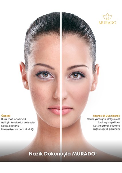 Nemlendiric| Hyaluronik Asit | C Vitamini | Kolajen | Niacinamide