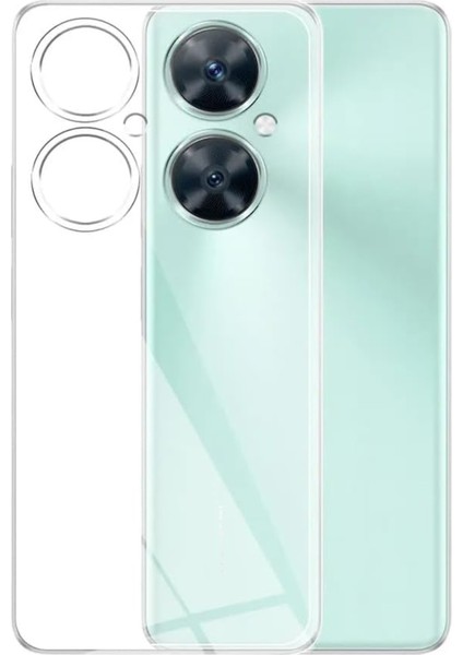 Caseworld Huawei Nova 11I ile Uyumlu Kapak Kamera Korumalı Süper Silikon Şeffaf Kılıf
