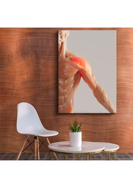Fizyoterapist - Kas Anatomisi ve Tedavi Kanvas Tablo