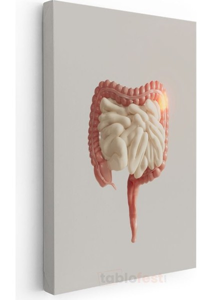Gastroenterolog - Kanvas Tablo modelleri