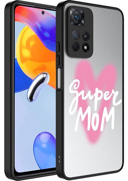 Xiaomi Redmi Note 11 Pro 5g Kılıf Aynalı Desenli Kamera Korumalı Parlak Uzrm Mirror Kapak-Süper Anne