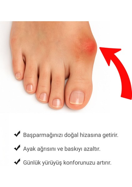 Ayak Baş Parmak Düzeltici Kemik Çıkıntısı Düzeltici Halluks Gece Ateli (1 Çift)