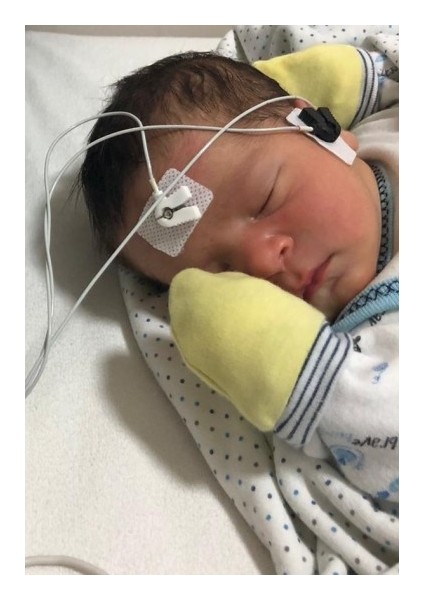 Abr Elektrod - Yenidoğan Işitme Tarama 10PAKET 30ADET fiyatları