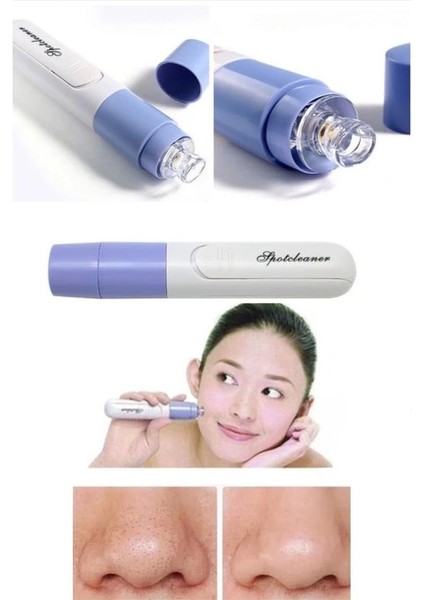 Pore Cleaner Vakumlu Yüz Temizleme Siyah Nokta Temizleme Cihazı - MBN6582-7734 modelleri