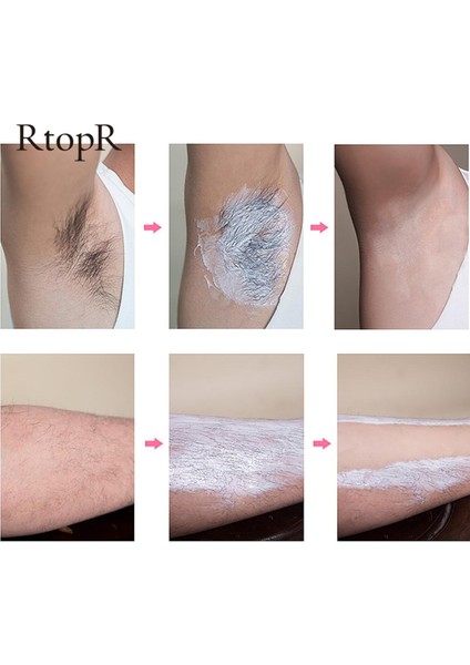 Mango Tüy Dökücü Vücut Etkili Epilasyon Kremi Evrensel Beyazlatma El Bacak Koltukaltı Saç Dökülmesi Epilasyon Şeritleri Balmumu (Yurt Dışından)