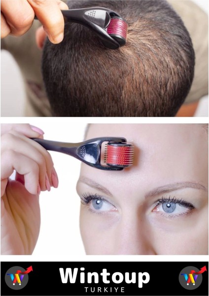 Yüksek Kaliteli 0.5 mm 540 Titanyum Iğneli Yenileyici Pürüzsüz Cilt Bakım Aleti Derma Roller modelleri