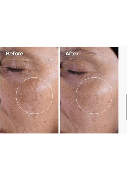 Glycolic Acid 7 %