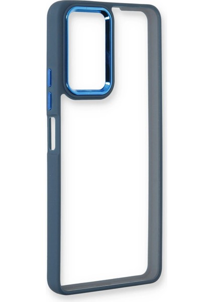 Xiaomi Redmi Note 11 Pro Kılıf Dora Kapak - Mavi Glstd
