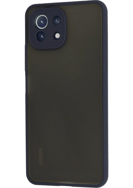 Xiaomi Mi 11 Lite Kılıf Montreal Silikon Kapak - Lacivert Glstd