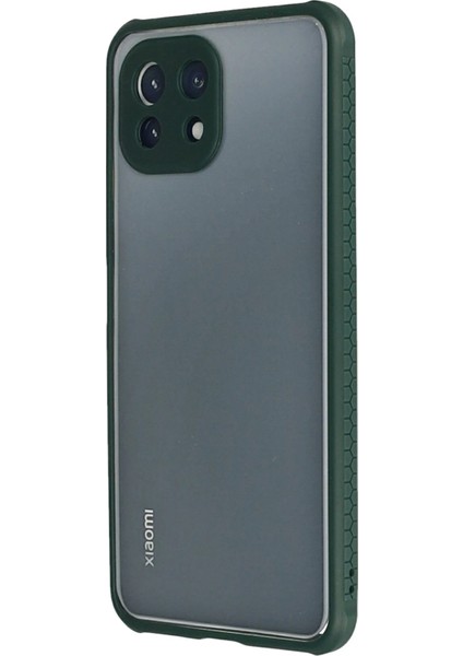 Xiaomi Mi 11 Lite Kılıf Miami Şeffaf Silikon - Koyu Yeşil Glstd