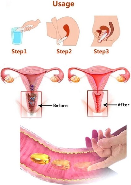 Özel Bölge Tam Kapsa ml ı Bakım Seti Genital Bakım Ozon Kapsül Yoğun Jel Seti 1 Adet fırsatları