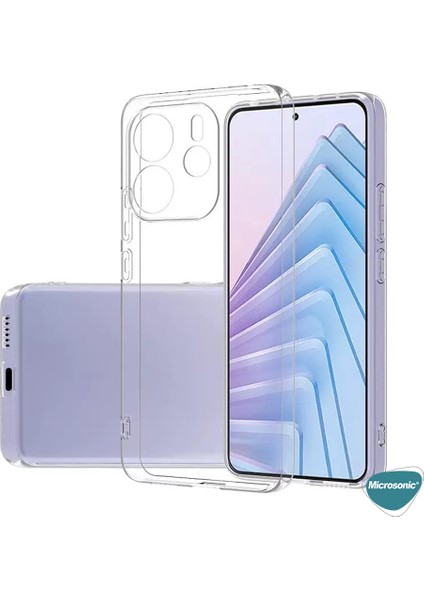Xiaomi Redmi Note 14 4g Kılıf Transparent Soft Şeffaf