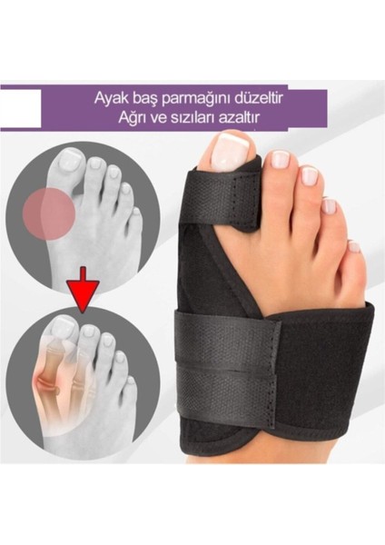 Ankaflex 1 Çift (Sağ-Sol) Halluks Vagus Gece Ateli Ayak Bunyon Kemik Koruyucu Düzeltici Başparmak Tedavisi