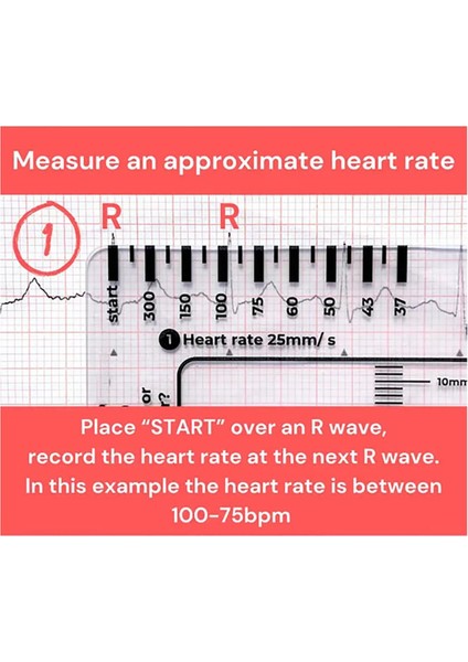 Adet Ekg 7 Adımlı Cetvel, Ekg/ekg Yorumlama Için Ekg 7 Adımlı Cetvel, (Yurt Dışından)