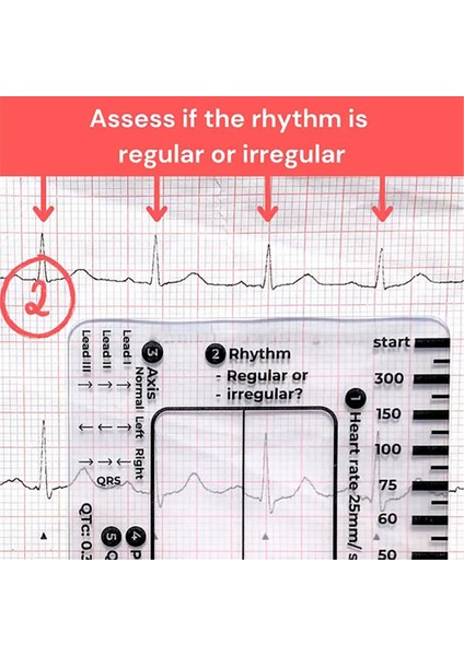 Adet Ekg 7 Adımlı Cetvel, Ekg/ekg Yorumlama Için Ekg 7 Adımlı Cetvel, (Yurt Dışından)