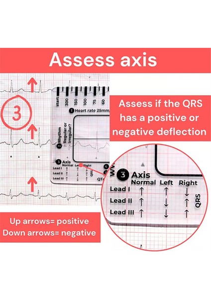 Adet Ekg 7 Adımlı Cetvel, Ekg/ekg Yorumlama Için Ekg 7 Adımlı Cetvel, (Yurt Dışından)