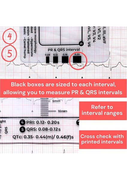 Adet Ekg 7 Adımlı Cetvel, Ekg/ekg Yorumlama Için Ekg 7 Adımlı Cetvel, (Yurt Dışından)