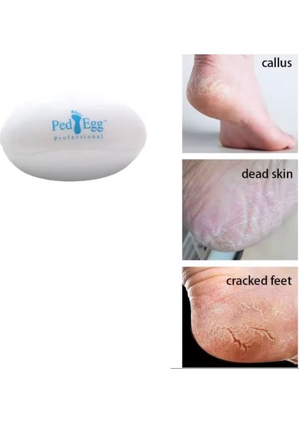 Ped Egg Ayak Bakım Törpüsü Topuk Rendesi