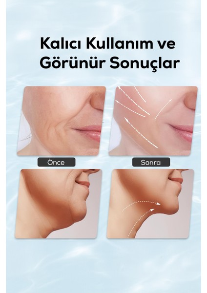 Gıdı ve Boyun Bölgesi Için Ems Destekli Cilt Toparlayıcı Cihaz – 3 Modlu indirimleri