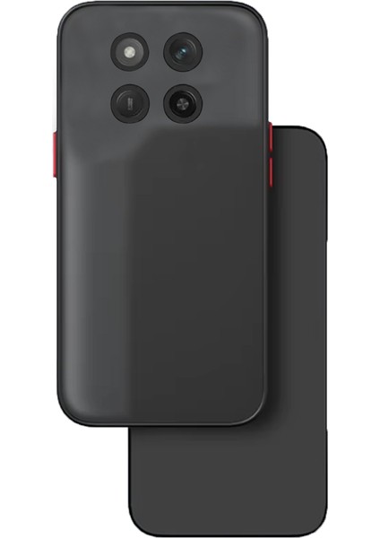 Huawei Honor Magic 7 Lite/honor X60 Pro 5g/honor X9C 5g London Serisi Darbeye Dayanıklı Kılıf - Siyah AL3415