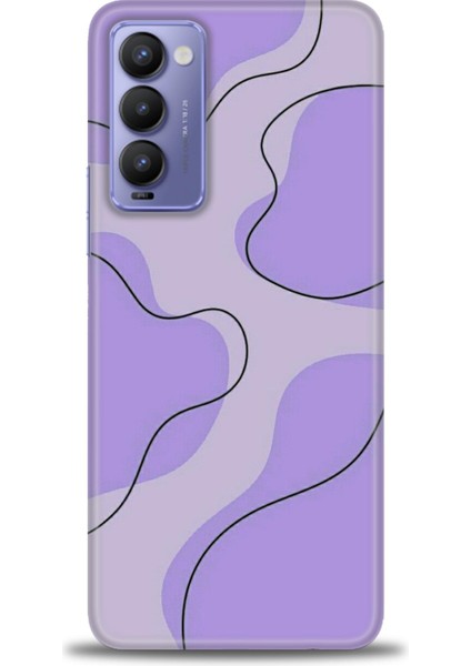Tecno Camon 18 Kılıf Hd Baskılı Kılıf + Seramik Tam Kaplayan Ekran Koruyucu 176
