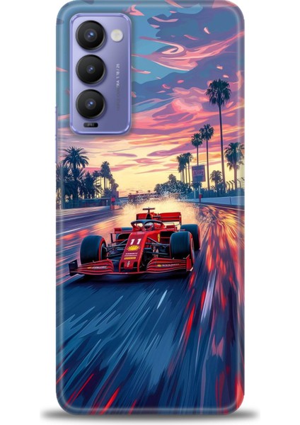 Tecno Camon 18P Kılıf Hd Baskılı Kılıf + Seramik Tam Kaplayan Ekran Koruyucu 102