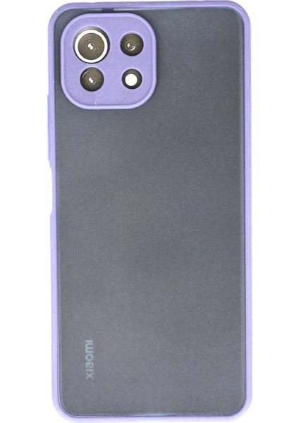Xiaomi Mi 11 Lite Kılıf Montreal Silikon Kapak - Mor Ynsmr