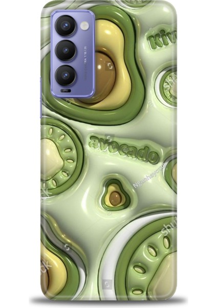 Tecno Camon 18P Kılıf Hd Baskılı Kılıf + Seramik Tam Kaplayan Ekran Koruyucu 114