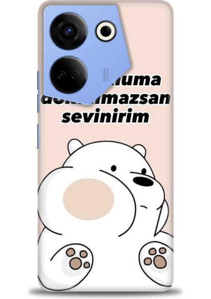 Tecno Camon 20 Pro 5g Kılıf Hd Baskılı Kılıf + Seramik Tam Kaplayan Ekran Koruyucu 158