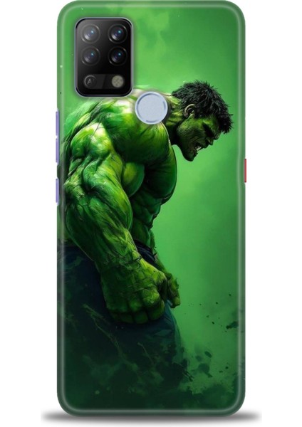 Tecno Pova Kılıf Hd Baskılı Kılıf + Seramik Tam Kaplayan Ekran Koruyucu 96