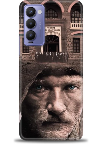 Tecno Camon 18P Kılıf Hd Baskılı Kılıf + Seramik Tam Kaplayan Ekran Koruyucu 30