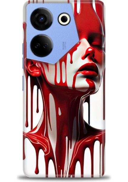 Tecno Camon 20 Pro 4g Kılıf Hd Baskılı Kılıf + Seramik Tam Kaplayan Ekran Koruyucu 150