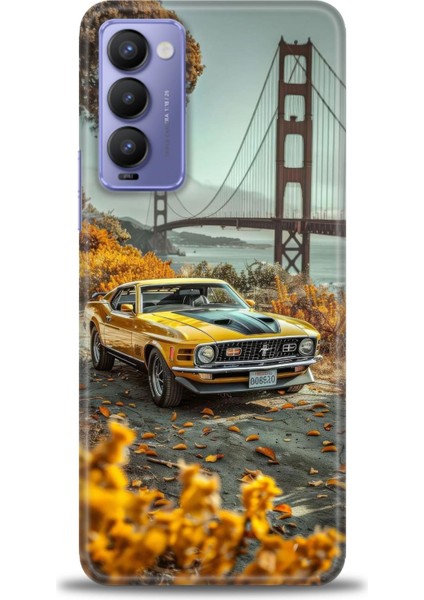 Tecno Camon 18 Kılıf Hd Baskılı Kılıf + Seramik Tam Kaplayan Ekran Koruyucu 105