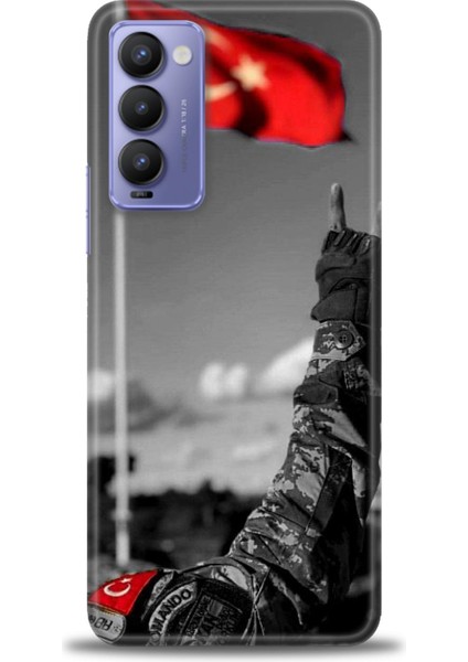 Tecno Camon 18P Kılıf Hd Baskılı Kılıf + Seramik Tam Kaplayan Ekran Koruyucu 35