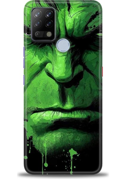 Tecno Pova Kılıf Hd Baskılı Kılıf + Seramik Tam Kaplayan Ekran Koruyucu 94