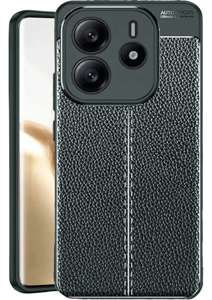 Xiaomi Redmi Note 14 4g Kılıf Kapak - Koyu Yeşil Ynsmr