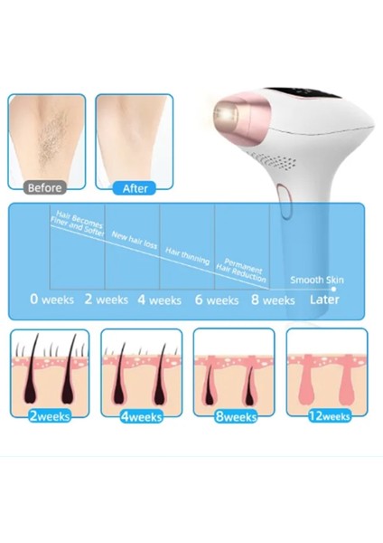 Nwn-4 Acısız Ipl Buz Lazer Epilasyon - Tüm Vücut - Tüm Ten Renkleri ile Uyumlu