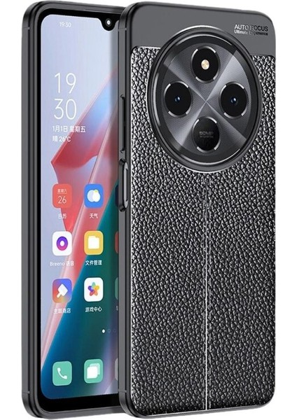 Redmi A4 Uyumlu Silikon Kılıf Deri Desenli Darbe Emici Autofocus Tam Koruma Kapak
