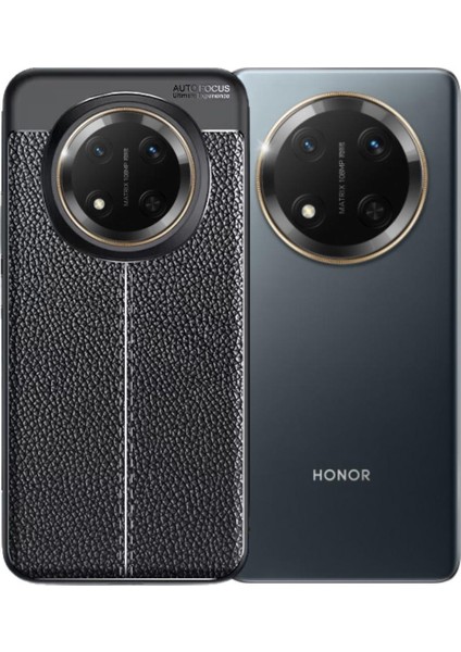 Honor X60 Pro Uyumlu Silikon Kılıf Deri Desenli Darbe Emici Autofocus Tam Koruma Kapak