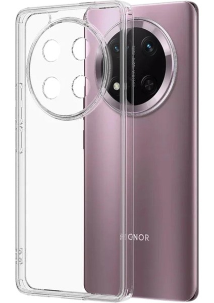 Honor X9C Uyumlu Şeffaf Silikon Kılıf - Kamera Korumalı Esnek Tam Koruma Kapak